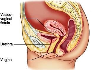 How far can someone deepthroat pics