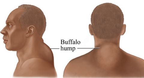 buffalo images