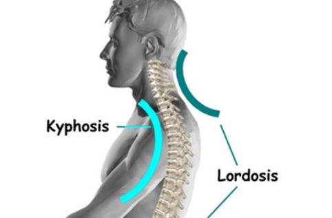 Image result for neck lordosis