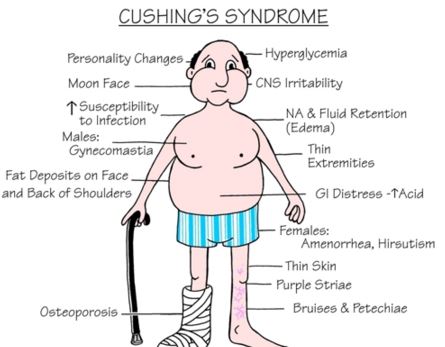 cushings syndrome symptoms