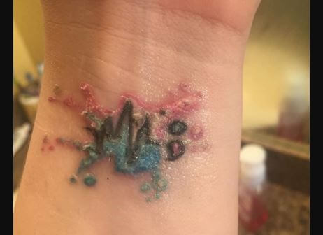 Infected Tattoo Images