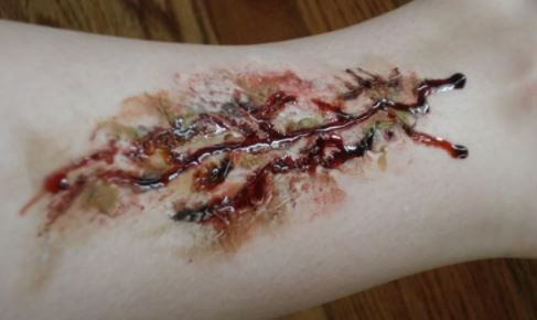 Infected Tattoo pics