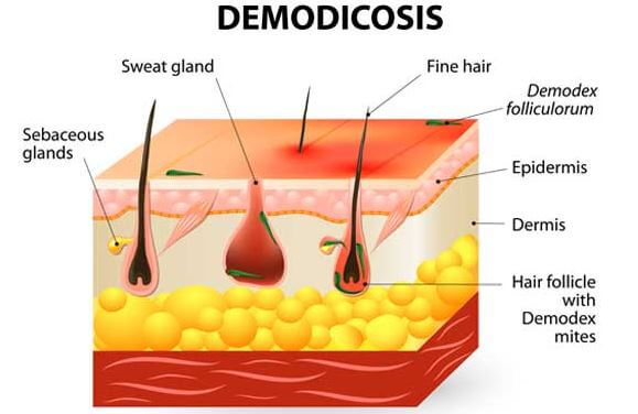 Demodicosis with hair follicle anatomy