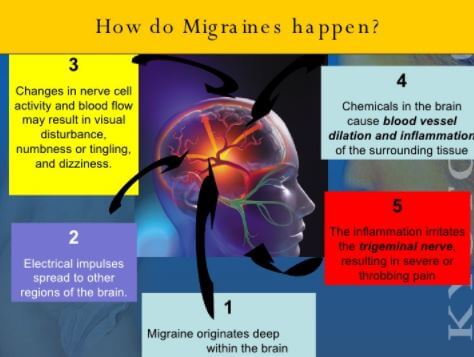 Ocular Migraine Symptoms